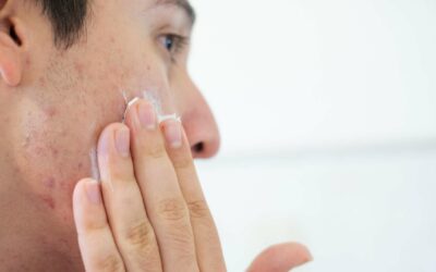 Les bienfaits du gel d’aloe vera Seven Minerals pour les peaux acnéiques