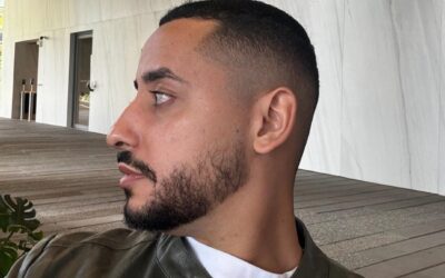 Greffe de cheveux FUE : comprendre cette technique moderne